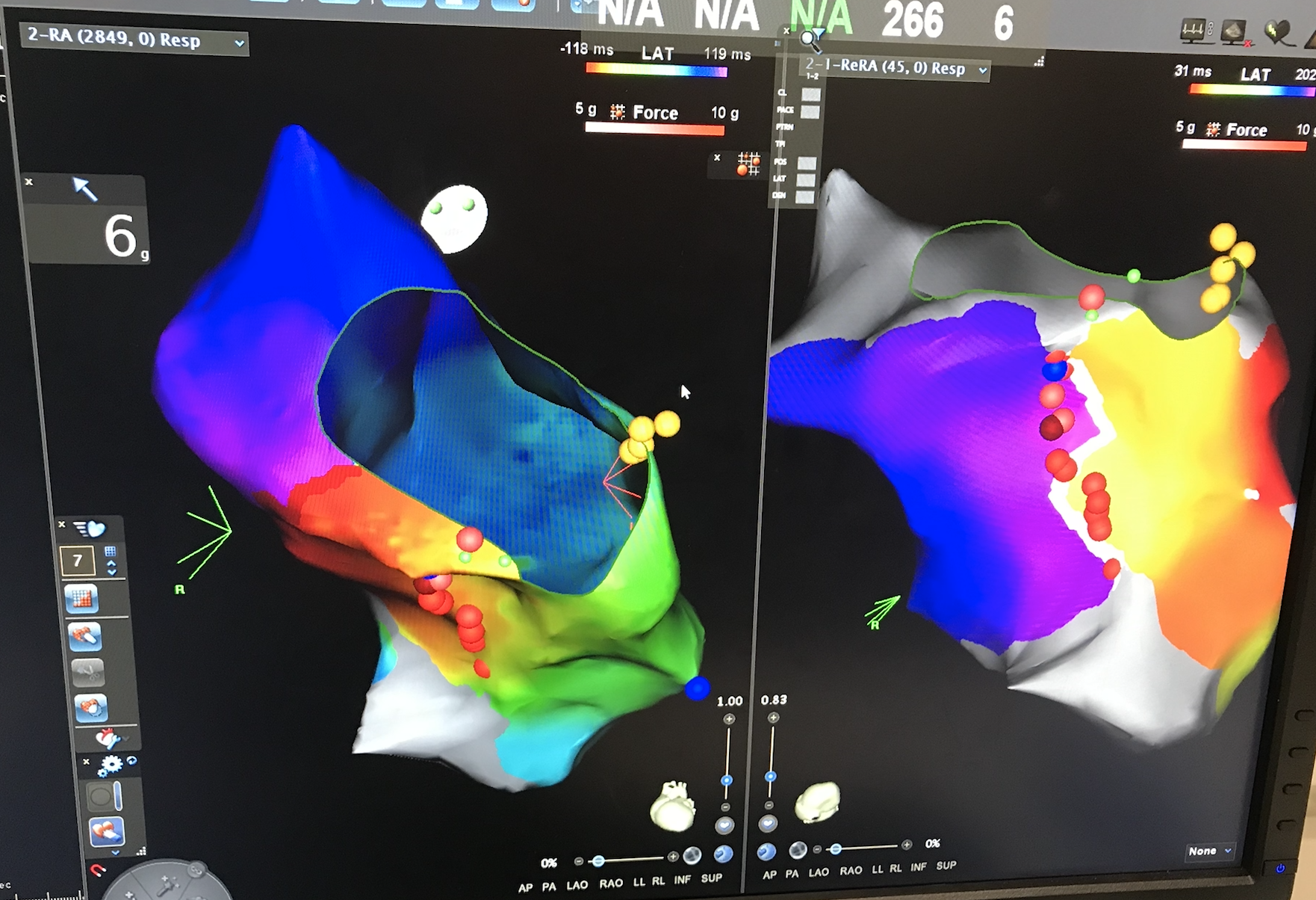 Cardiac Electrophysiology imaging