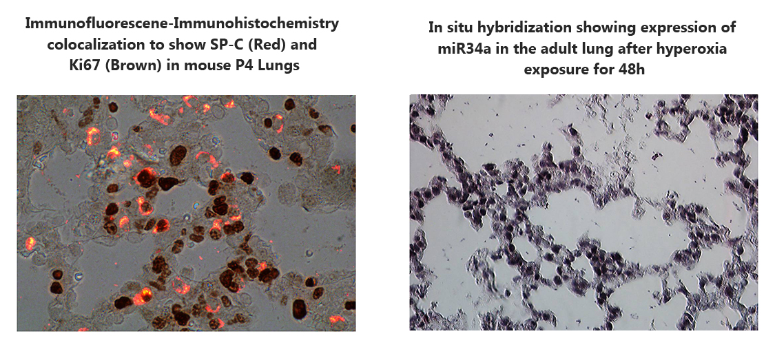 immuno