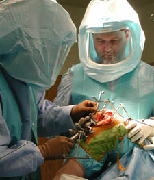 knee replacement surgery