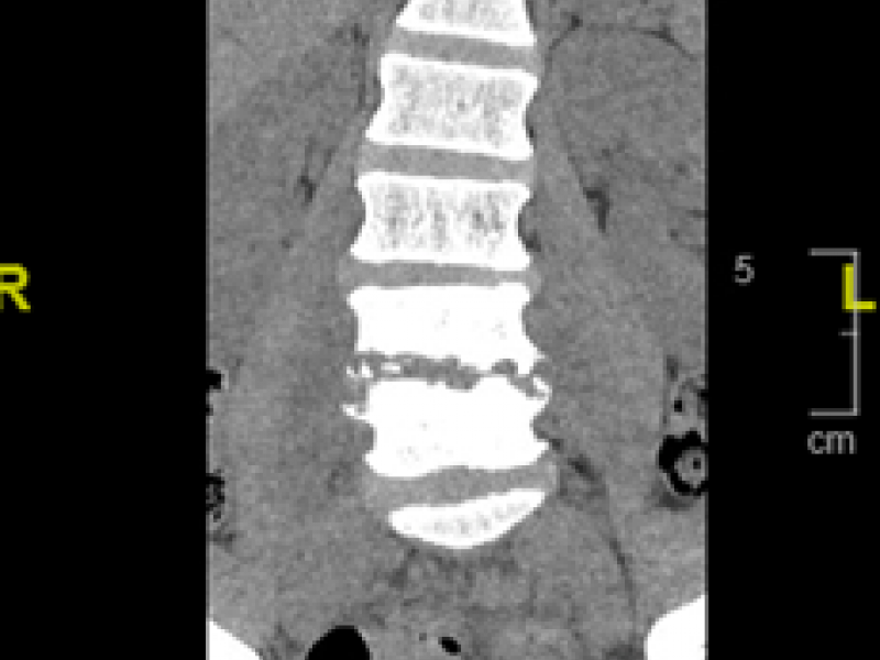 Critical Cases - Back pain emergency!