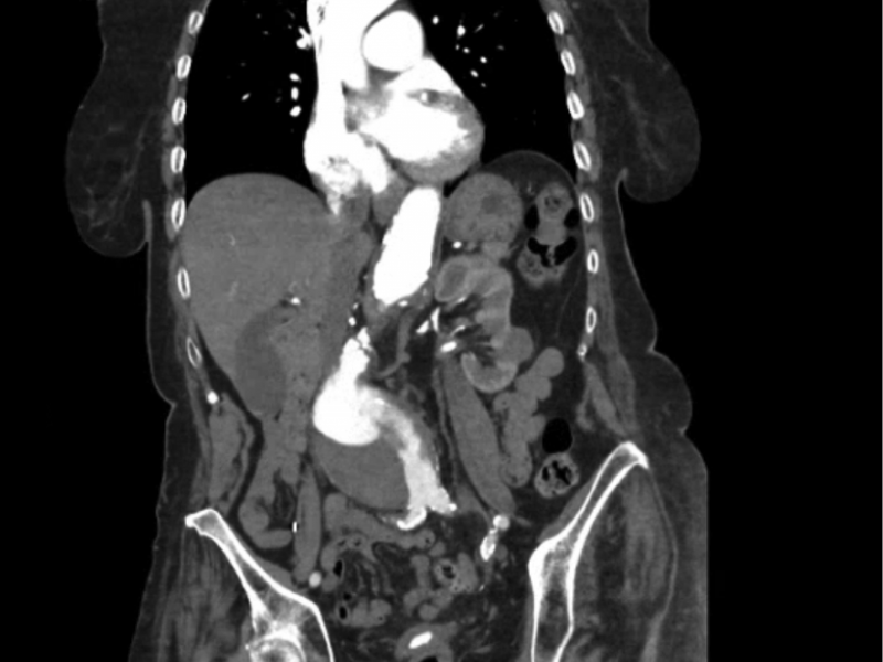 What's the Diagnosis? By Dr. Sarab Sodhi