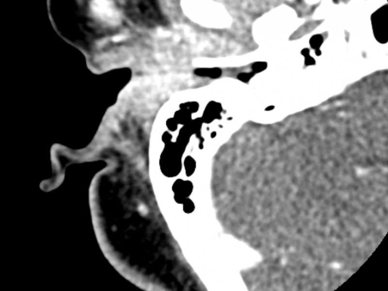 What's the Diagnosis?  By Dr. Jillian Smith