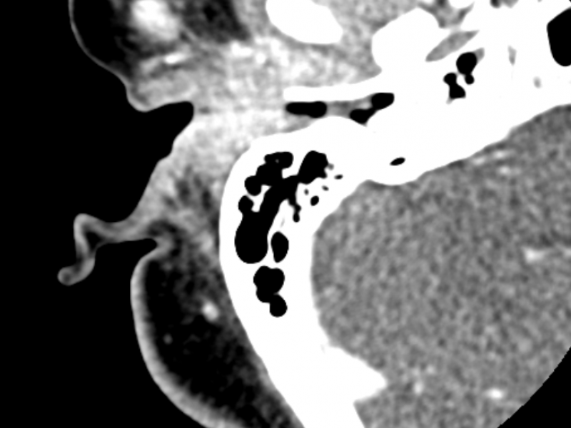 What's the Diagnosis? By Dr. Jillian Smith 