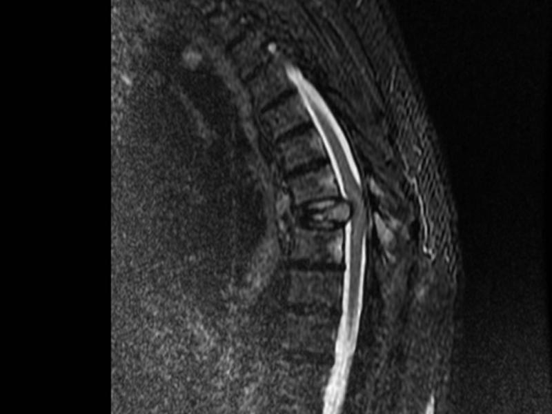 What's the Diagnosis?  By Dr. Michael Tom