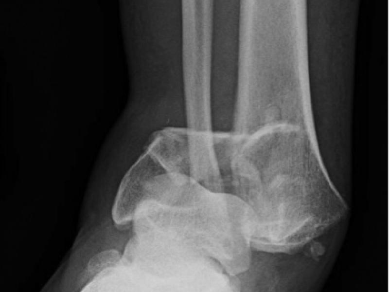 What's the Diagnosis? By Dr. Erica Schramm