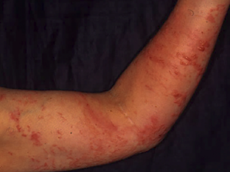 Board Review: Dermatology 