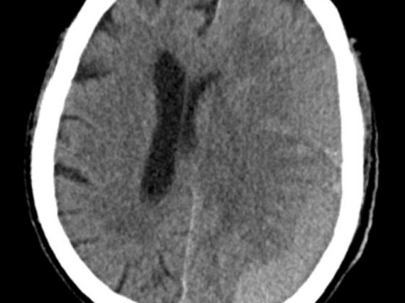 What's the Diagnosis? By Dr. Sarab Sodhi