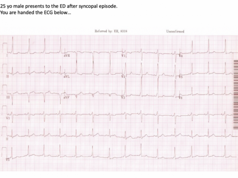 #EMConf: ECG review