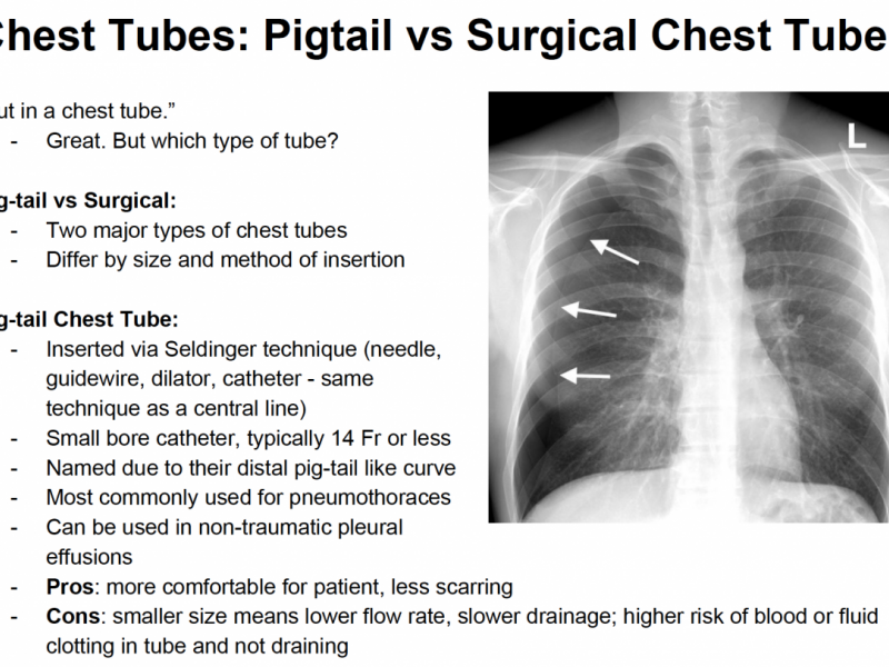 Back to Basics: Chest Tubes