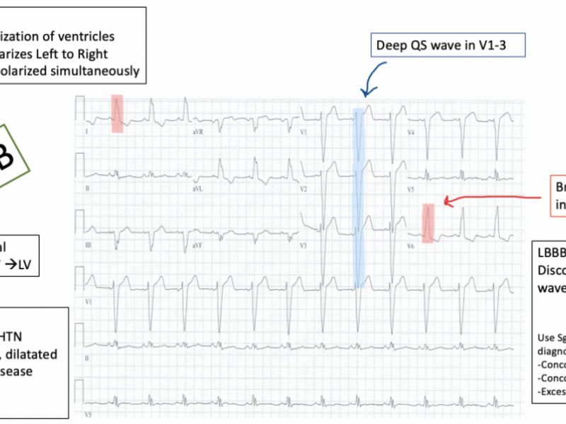 #EMConf: ECG review