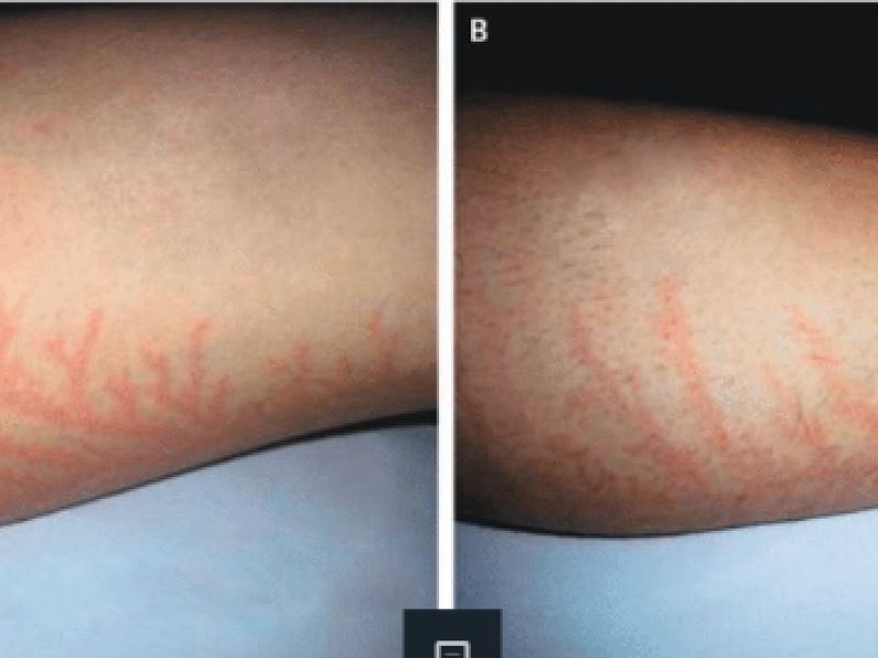 #EMConf: Lightning Injuries