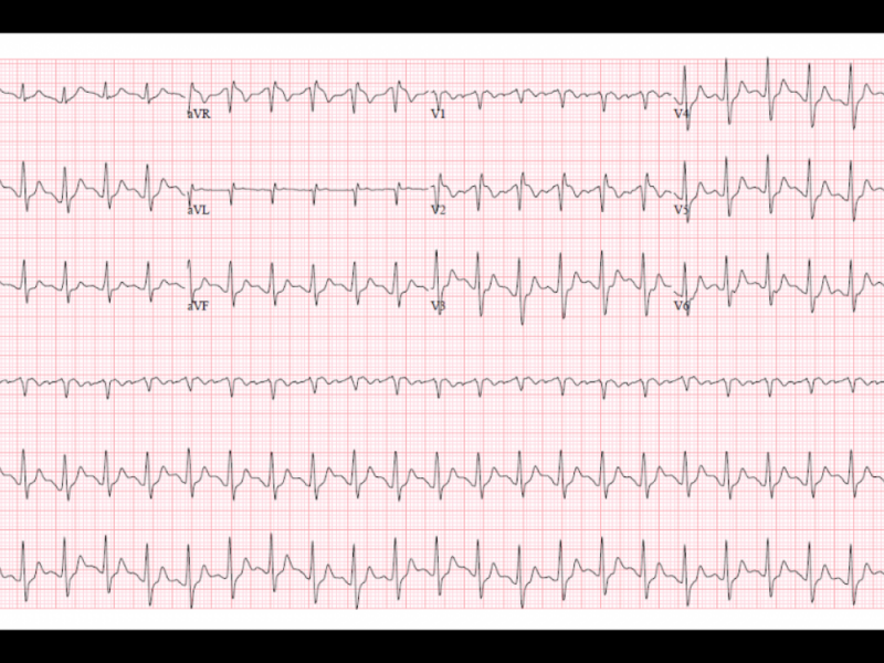 What's the Diagnosis (the Critical Care edition)? By Dr. Grace Lam