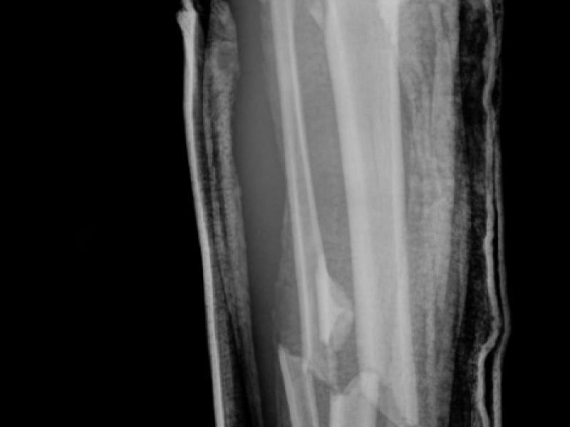 What's the diagnosis? By Dr. Abby Renko