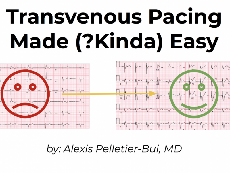 Back to Basics: Transvenous Pacing