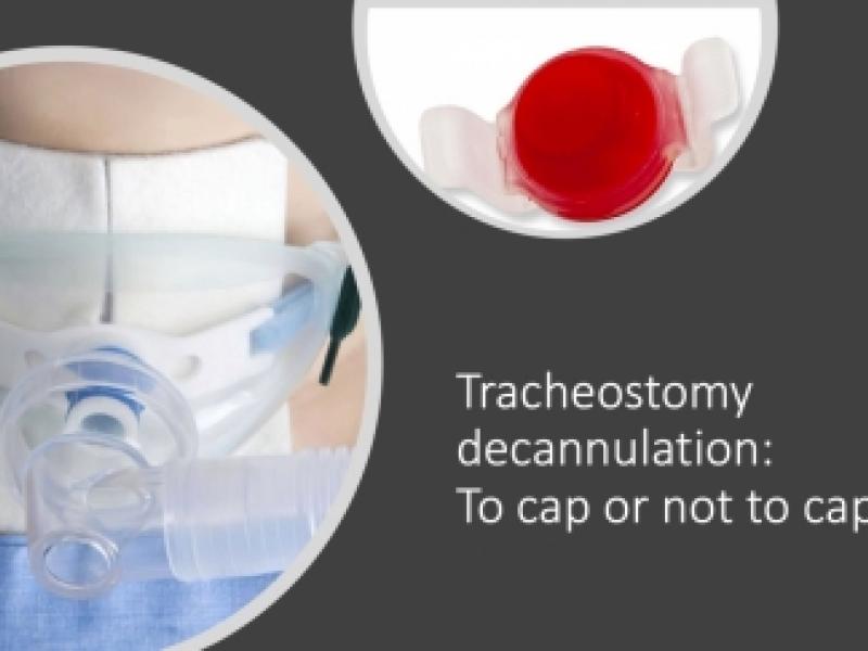Tracheostomy decannulation: To cap or not to cap?