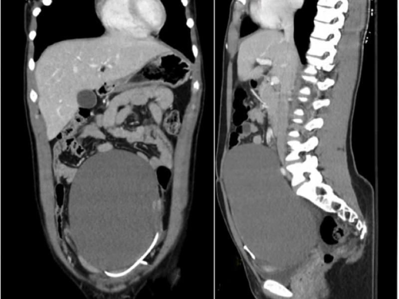 What's the Diagnosis? By Dr. Lauren Murphy