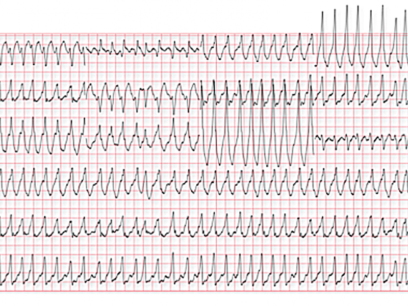 What's the Diagnosis? (the Critical Care edition). By Dr. Kara Houston