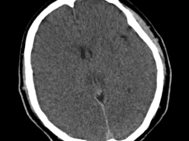 What's the Diagnosis?  By Dr. Sarab Sodhi