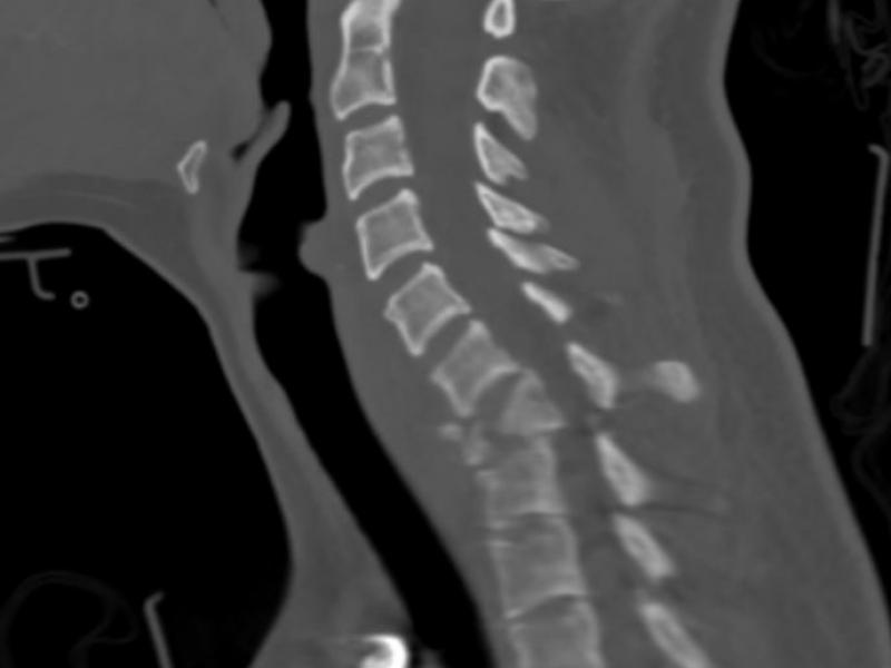 What's the Diagnosis?  By Dr. Sarab Sodhi