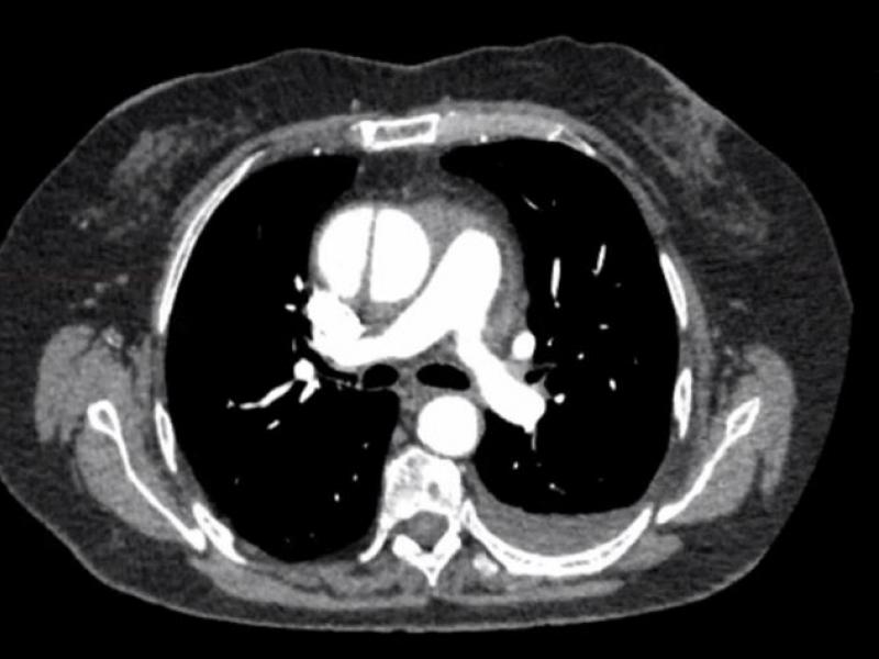 What's the Diagnosis? By Dr. Loran Hatch