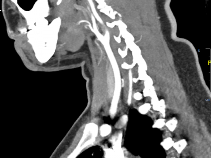 What's the Diagnosis? By Dr. Patrice Baptista