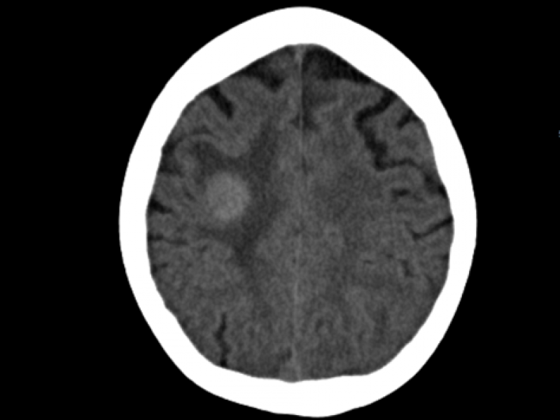 What's the Diagnosis? By Dr. Erica Schramm