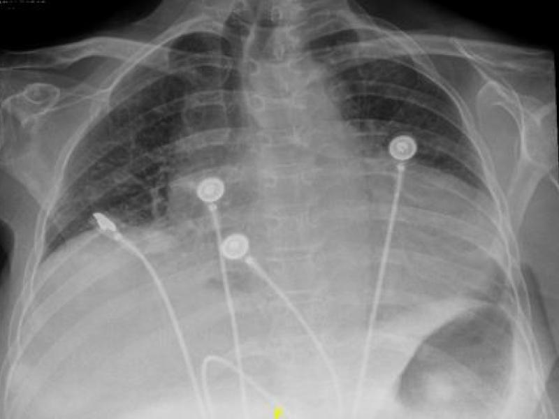 What's the Diagnosis? By Dr. Eric Chavis