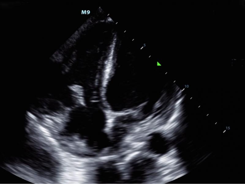 What's the Diagnosis?  By Dr. Michael Tom