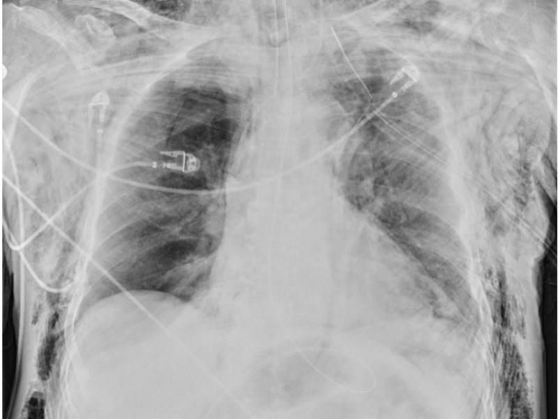 What's the Diagnosis? By Dr. Sarab Sodhi