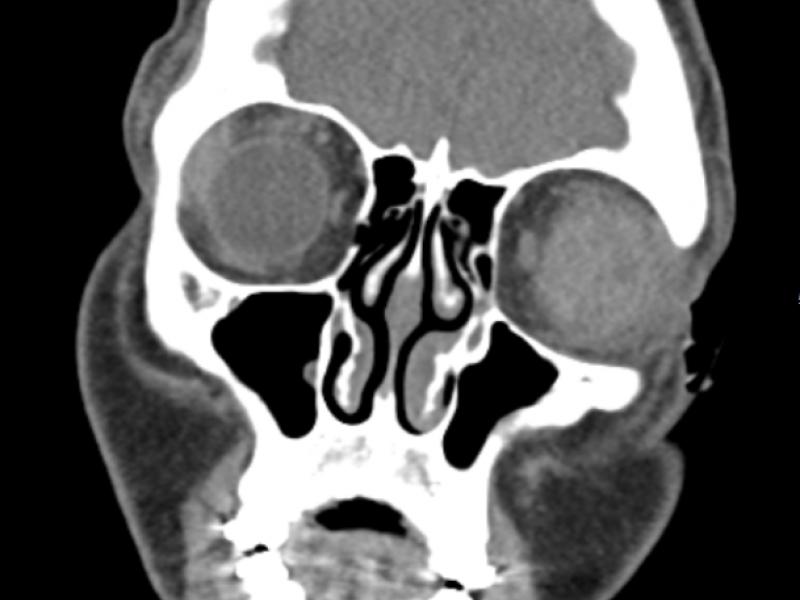 What's the Diagnosis? By Dr. Lauren Murphy