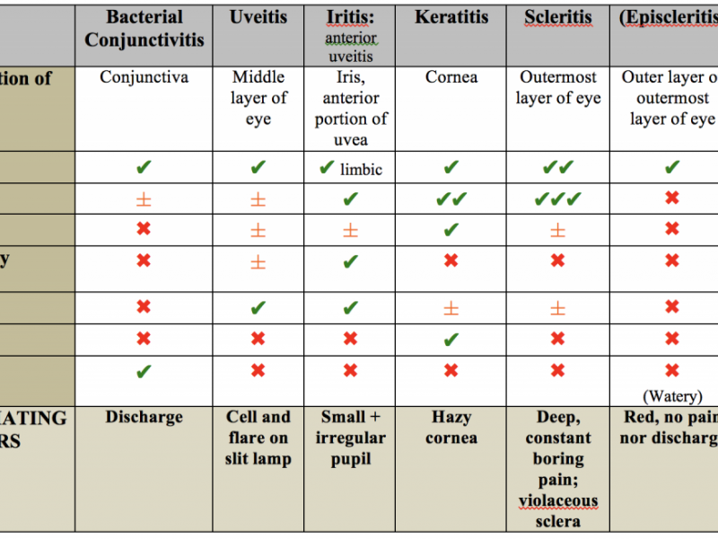 Back to Basics: "Eye"tis