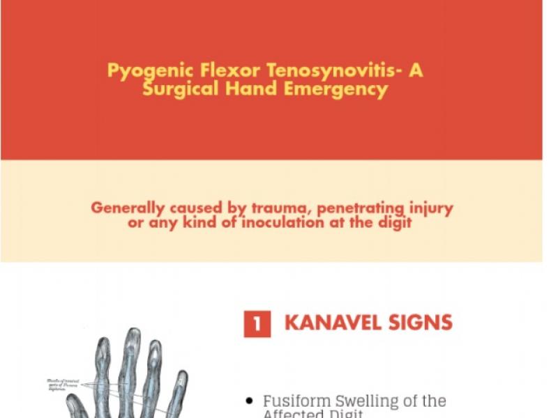 Advanced Practice: Flexor Tenosynovitis 