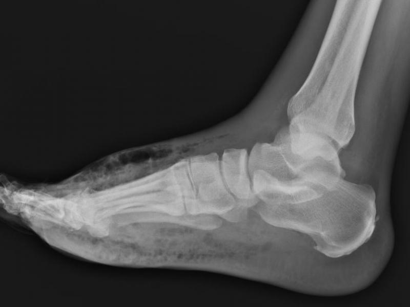 What's the diagnosis? By Dr. Katie Selman