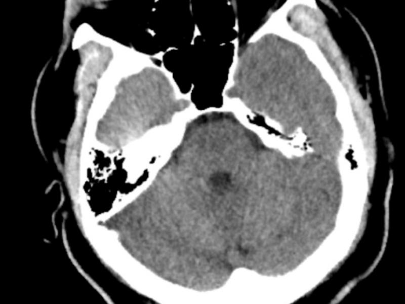 What's the diagnosis? By Dr. Loran Hatch