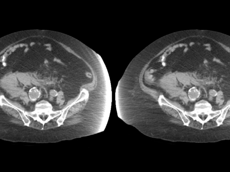 What's the Diagnosis? By Dr. Sarab Sodhi