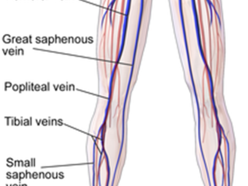 What's the Diagnosis? By Jake Barr, MS3