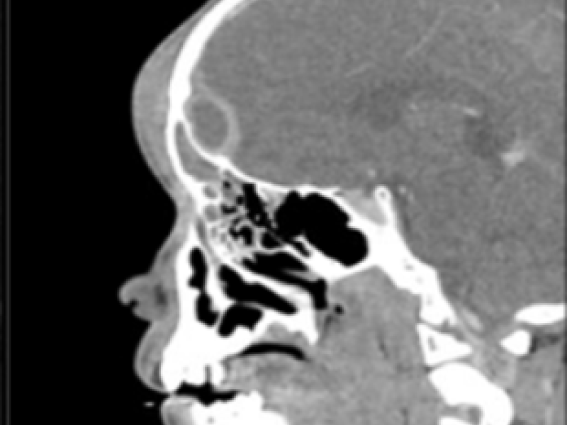 What is the Diagnosis? By Dr. Allison Cash