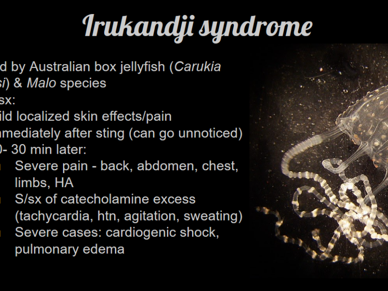 Back to Basics: Irukandji Syndrome