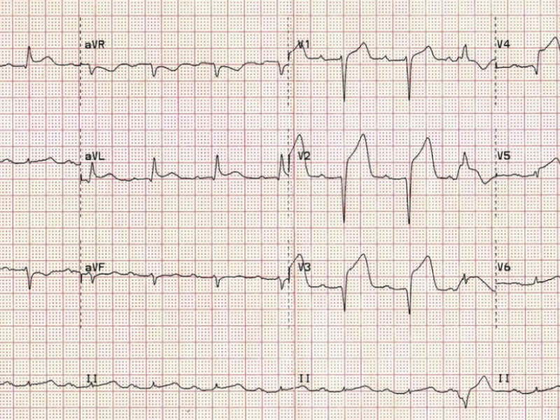 What’s the Diagnosis? The Critical Care edition Case by Dr. Grace Lam