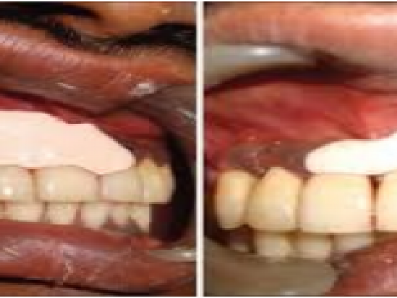 #EMconf: Dental Emergencies