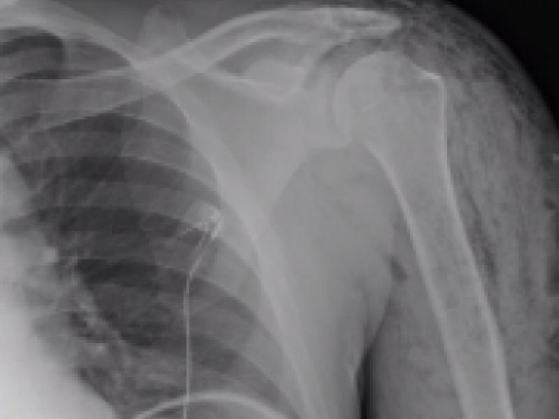 What's the diagnosis? By Dr. Caroline Blatcher