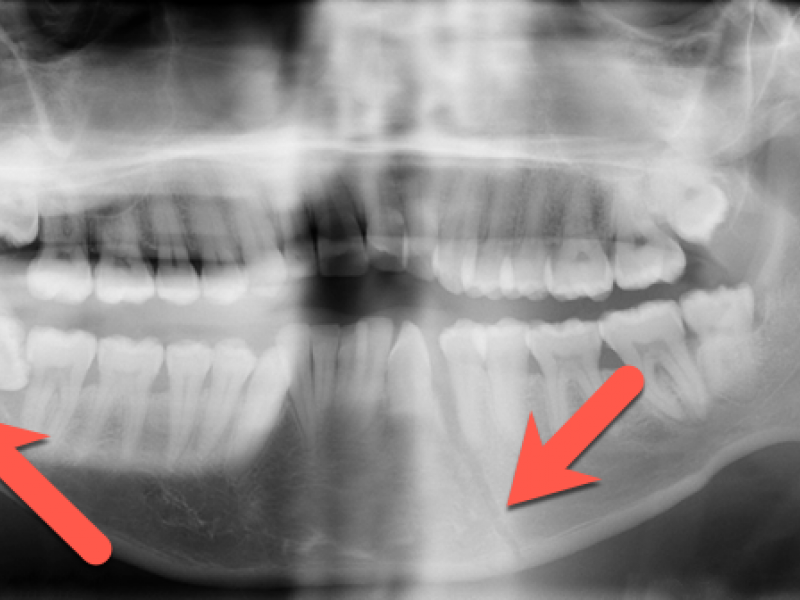 What's the Diagnosis? Case by Dr. Erica Schramm