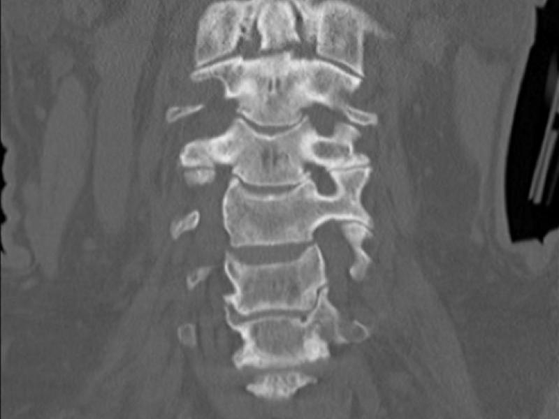 What's the diagnosis?  By Dr. Eric Chavis