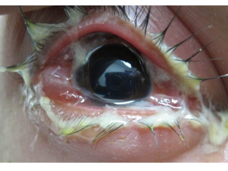 Board Review: Are we seeing eye to eye?