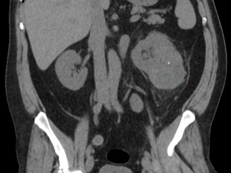 What's the Diagnosis? By Dr. Loran Hatch