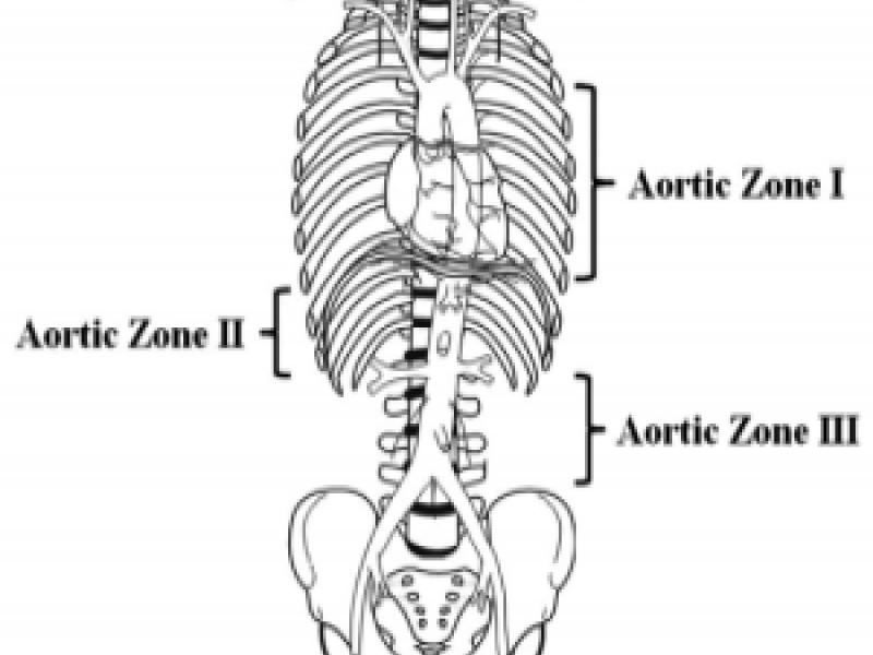 #EMconf: Traumatic Arrest and REBOA 