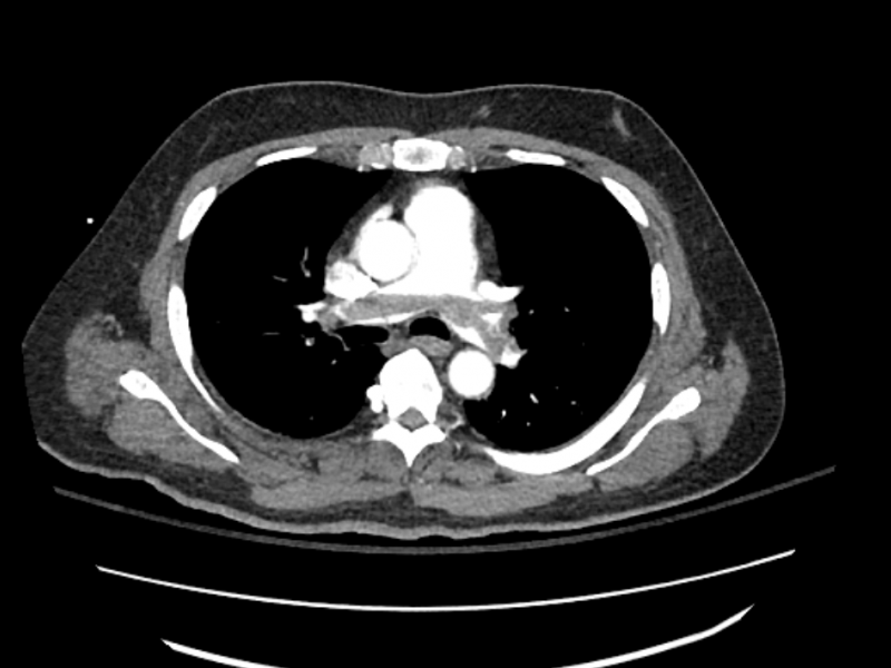 What's the diagnosis? By Dr. Angela Ugorets