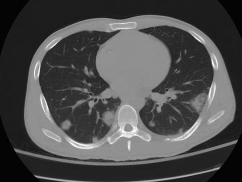 What's the Diagnosis? By Dr. Michael Tom