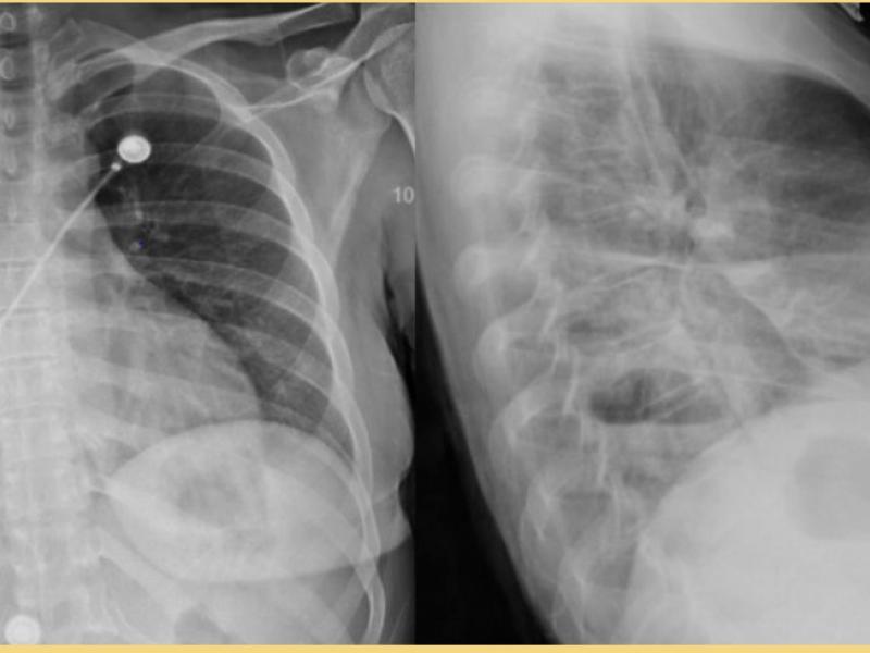 What's the diagnosis? By Dr. Becca Fieles