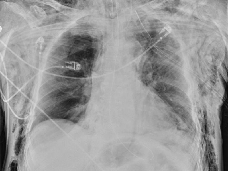 What's the Diagnosis? By Dr. Sarab Sodhi